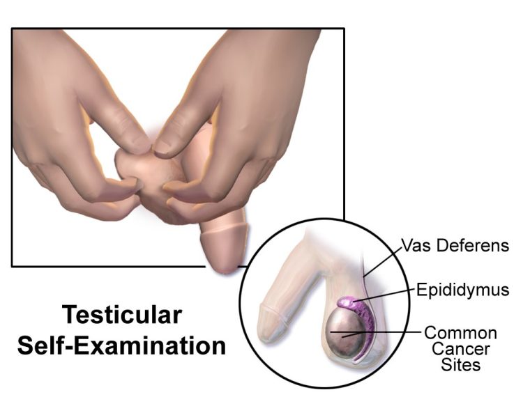Schema dell’autopalpazione del testicolo, con epididimo e dotto deferente indicati