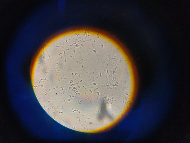 Campo microscopico con spermatozoi umani, come si osservano durante lo spermiogramma